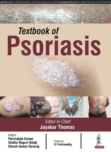 Jayakar Thomas Textbook of Psoriasis (Paperback) (UK IMPORT)