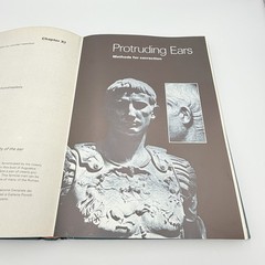 Plastic Surgery: New Methods and Refinements Tord Skoog 1974 HC VTG Medical Book