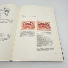 Plastic Surgery: New Methods and Refinements Tord Skoog 1974 HC VTG Medical Book