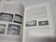 Crown and Bridge Prosthesis Stanley D. Tylman, 1949 Denistry book HC