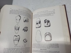 Crown and Bridge Prosthesis Stanley D. Tylman, 1949 Denistry book HC