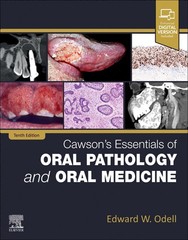 Cawson’s Essentials of Oral Pathology and Oral Medicine
