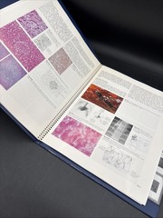 Slide Atlas Of Gastroenterology Metabolic Vascular Disorders Tumors 58 Slides