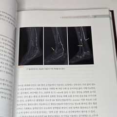 당뇨성 창상의 이해와 치료 (Management of Diabetic Wound) by Han Seung-kyu (한승규) 2008 Korean