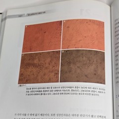 당뇨성 창상의 이해와 치료 (Management of Diabetic Wound) by Han Seung-kyu (한승규) 2008 Korean