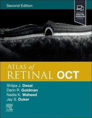 Atlas of Retinal OCT: Optical Coherence – Hardcover, by Duker MD Jay – New m