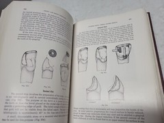 Crown and Bridge Prosthesis Stanley D. Tylman, 1949 Denistry book HC