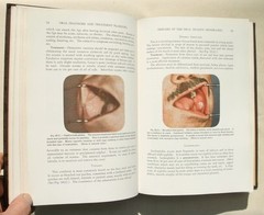 Oral Diagnosis And Treatment Planning by Samuel Charles Miller 1936