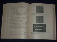 1921 GYNECOLOGICAL & OBSTETRICAL MONOGRAPHS APPLETON VOLUME LOT OF 14 – KD 2998