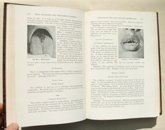 Oral Diagnosis And Treatment Planning by Samuel Charles Miller 1936