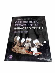 Adrian Becker Orthodontic Treatment of Impacted Teeth