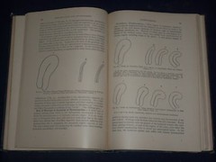 1921 GYNECOLOGICAL & OBSTETRICAL MONOGRAPHS APPLETON VOLUME LOT OF 14 – KD 2998