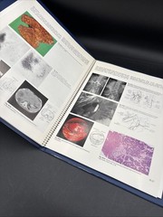 Slide Atlas Of Gastroenterology Metabolic Vascular Disorders Tumors 58 Slides