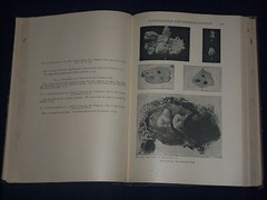 1921 GYNECOLOGICAL & OBSTETRICAL MONOGRAPHS APPLETON VOLUME LOT OF 14 – KD 2998