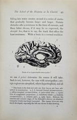 1895 Hypnotism Foveau de Courmelles – Antique Occult Psychology Book Hypnotism