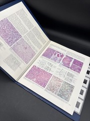 Slide Atlas Of Gastroenterology Metabolic Vascular Disorders Tumors 58 Slides